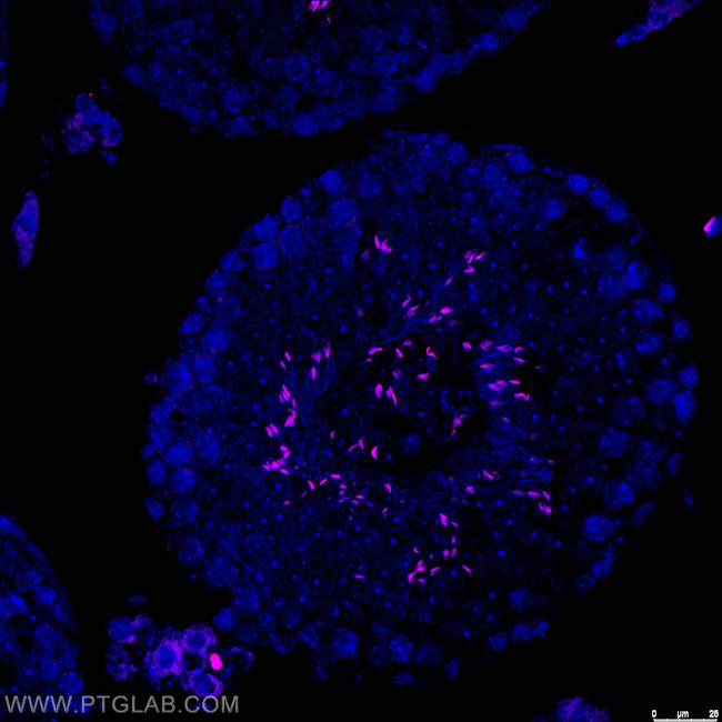 TNP1 Antibody in Immunohistochemistry (Paraffin) (IHC (P))