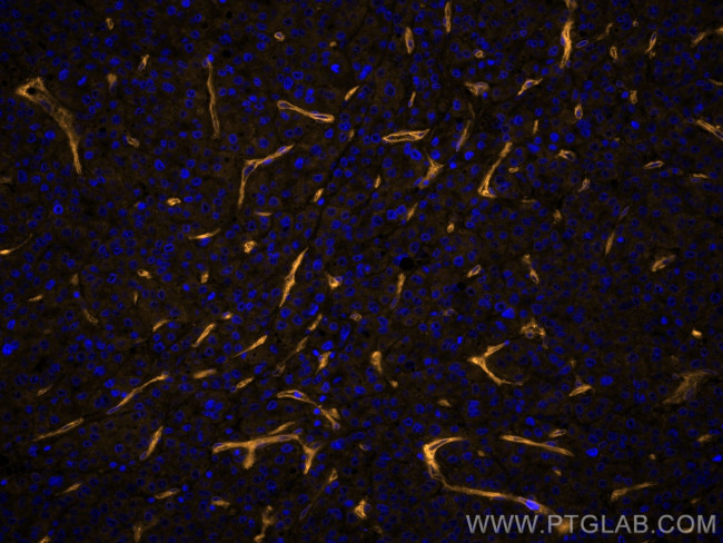 CD146/MCAM Antibody in Immunohistochemistry (Paraffin) (IHC (P))