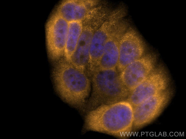 14-3-3 Sigma Antibody in Immunocytochemistry (ICC/IF)