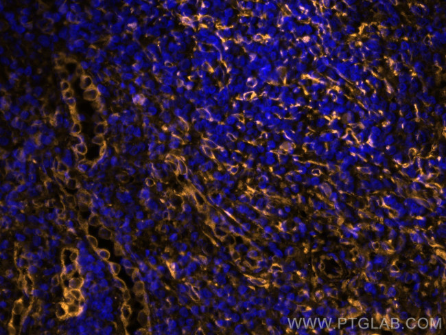 TMEM173/STING Antibody in Immunohistochemistry (Paraffin) (IHC (P))