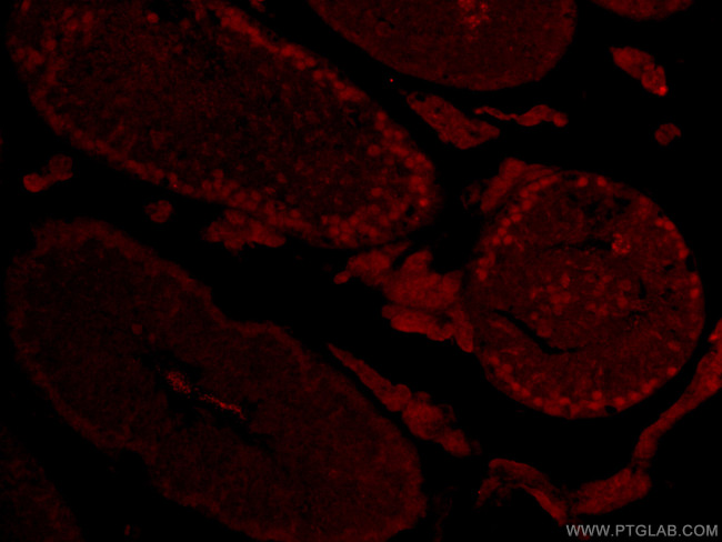 SPATA22 Antibody in Immunohistochemistry (PFA fixed) (IHC (PFA))