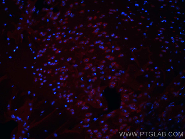 Ataxin 2 Antibody in Immunohistochemistry (PFA fixed) (IHC (PFA))