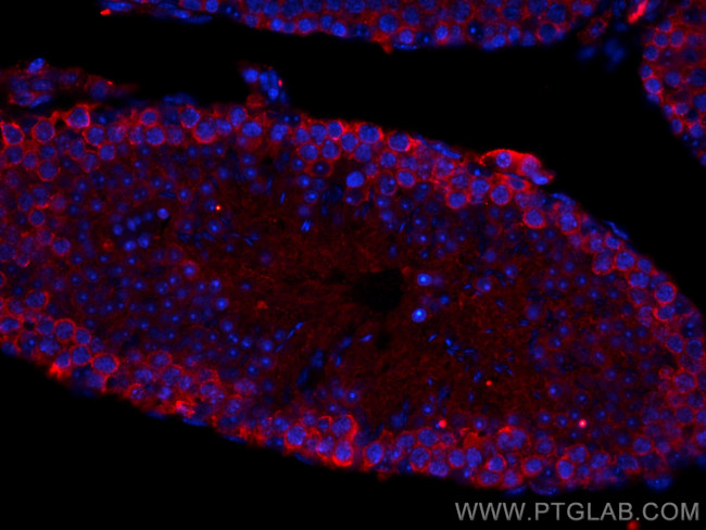 C9orf72 Antibody in Immunohistochemistry (PFA fixed) (IHC (PFA))