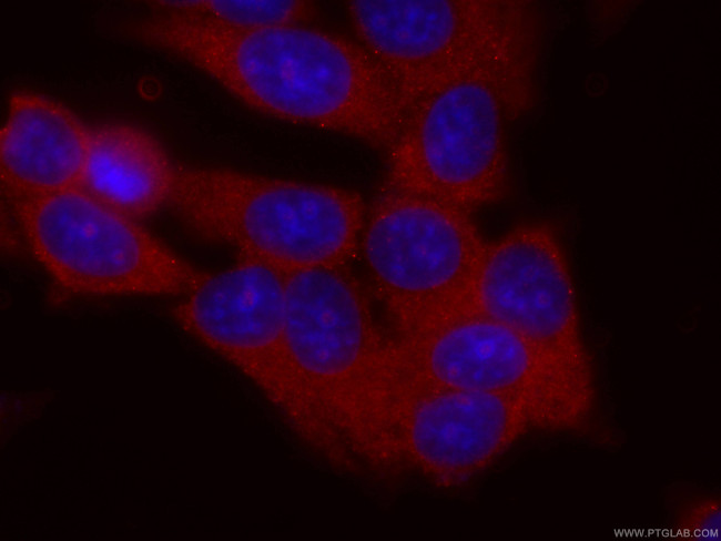 DBC1 Antibody in Immunocytochemistry (ICC/IF)