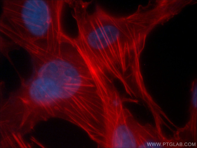 beta Actin Antibody in Immunocytochemistry (ICC/IF)