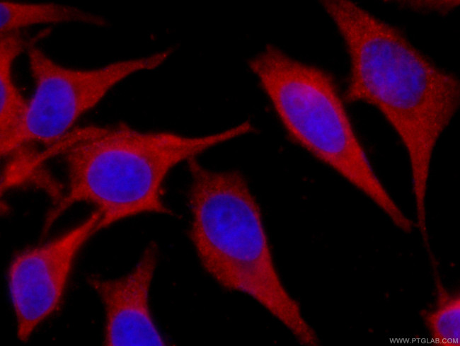 SEC5/EXOC2 Antibody in Immunocytochemistry (ICC/IF)