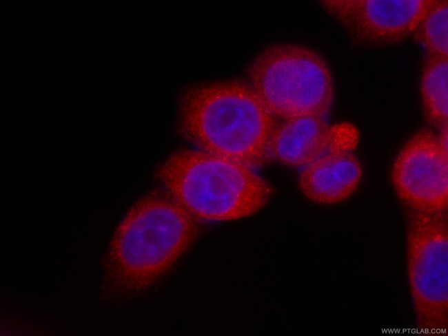 LPCAT1 Antibody in Immunocytochemistry (ICC/IF)