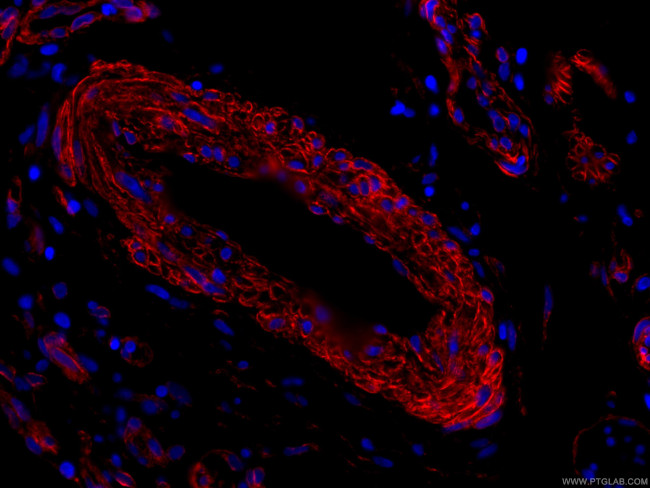 Caveolin-1 Antibody in Immunohistochemistry (PFA fixed) (IHC (PFA))