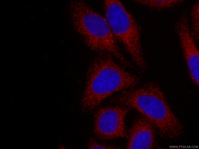 Alpha galactosidase A Antibody in Immunocytochemistry (ICC/IF)