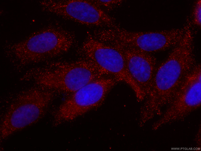 PAI-1 Antibody in Immunocytochemistry (ICC/IF)