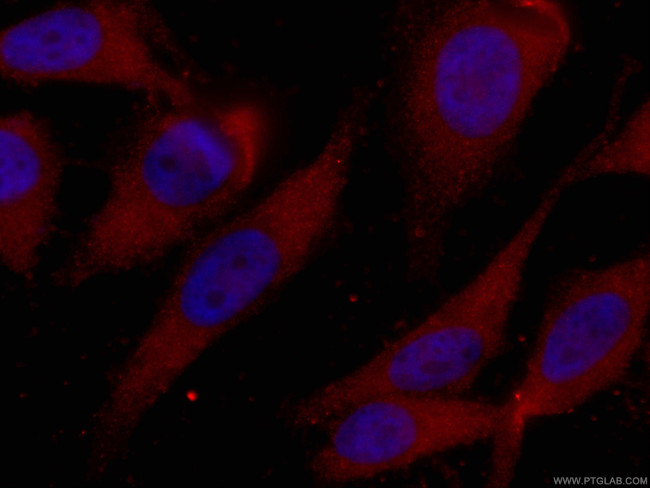 CDK6 Antibody in Immunocytochemistry (ICC/IF)