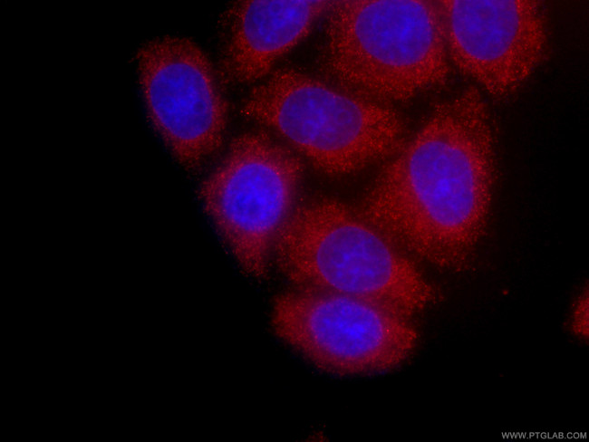 GSDMD Antibody in Immunocytochemistry (ICC/IF)