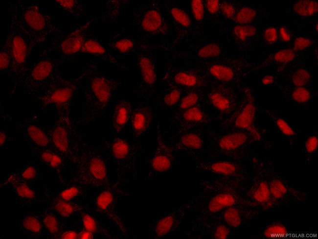 PARP1 Antibody in Immunocytochemistry (ICC/IF)