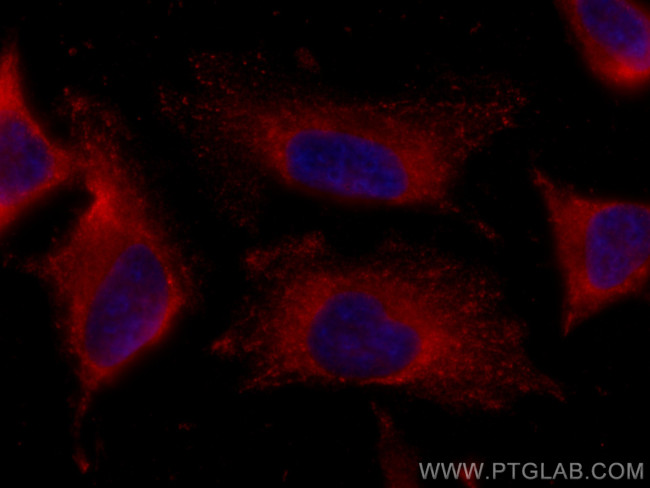 ATG13 Antibody in Immunocytochemistry (ICC/IF)