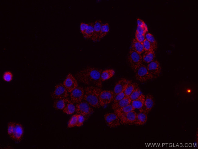 MFN1 Antibody in Immunocytochemistry (ICC/IF)