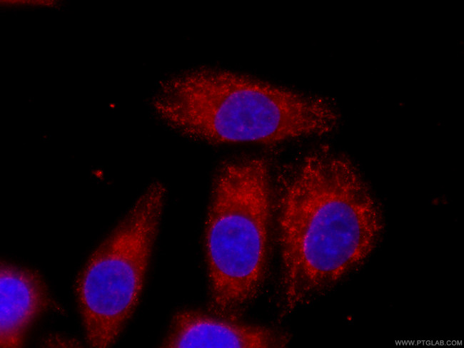 MFN1 Antibody in Immunocytochemistry (ICC/IF)