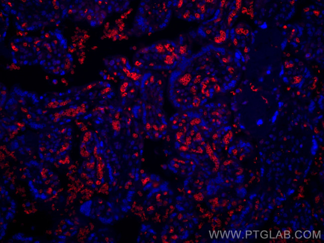 band 3/AE1 Antibody in Immunohistochemistry (PFA fixed) (IHC (PFA))