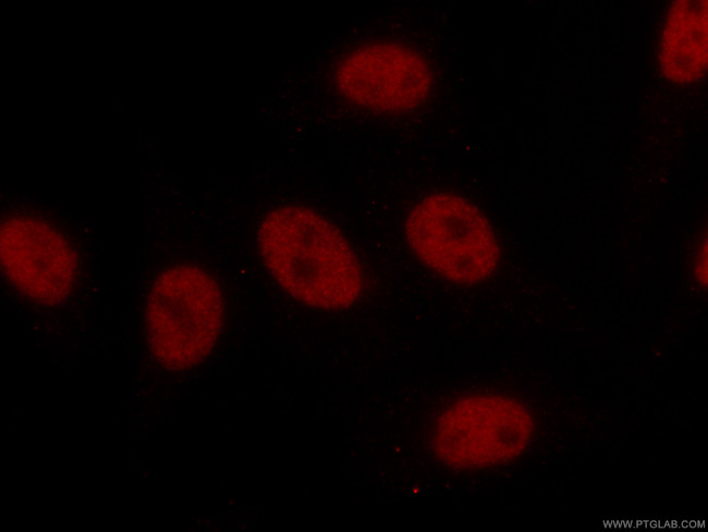 TCF3 Antibody in Immunocytochemistry (ICC/IF)