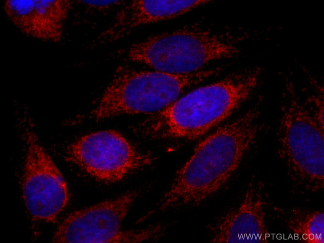 FIS1 Antibody in Immunocytochemistry (ICC/IF)