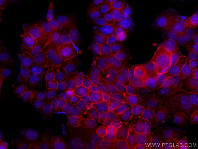 Occludin Antibody in Immunocytochemistry (ICC/IF)