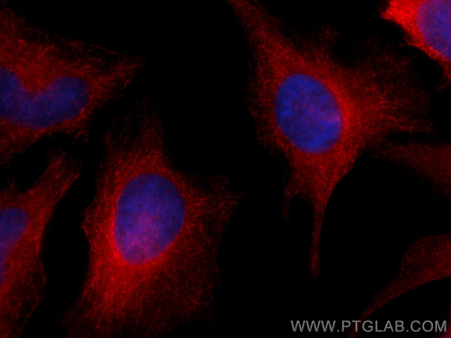 SPAG5 Antibody in Immunocytochemistry (ICC/IF)