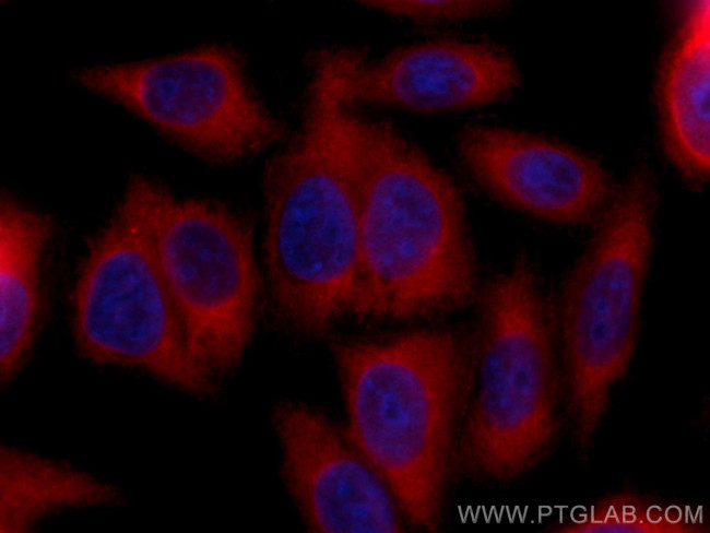 CTP synthase Antibody in Immunocytochemistry (ICC/IF)