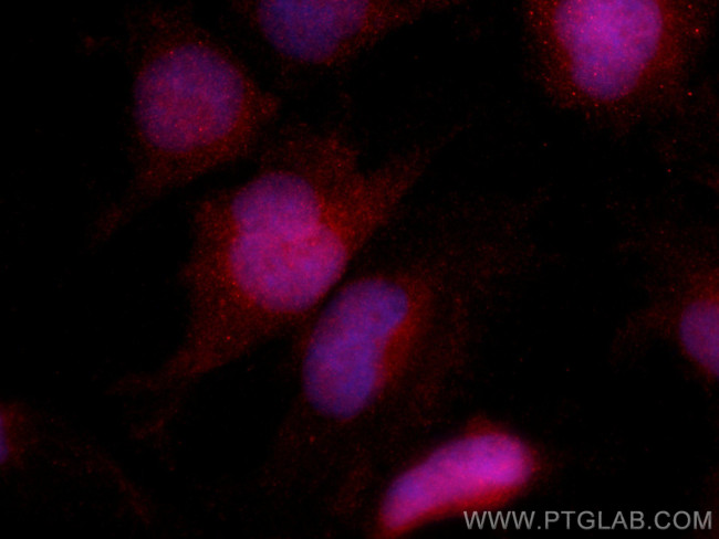 NFATC2 Antibody in Immunocytochemistry (ICC/IF)