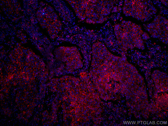 CD9 Antibody in Immunohistochemistry (Paraffin) (IHC (P))