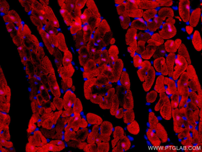 FABP3 Antibody in Immunohistochemistry (Paraffin) (IHC (P))