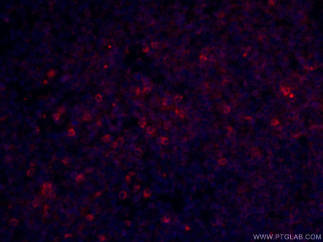 CD3 gamma Antibody in Immunohistochemistry (Paraffin) (IHC (P))