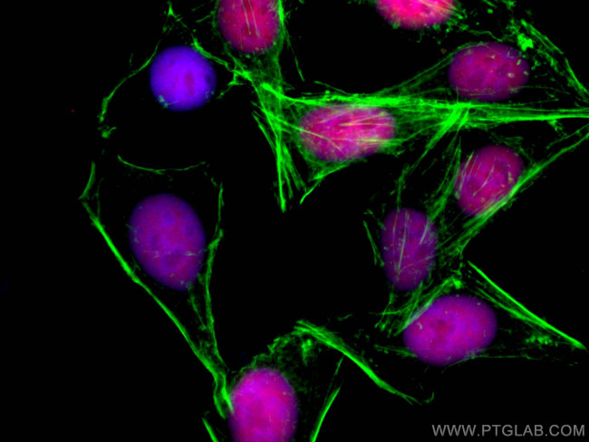 ANP32B Antibody in Immunocytochemistry (ICC/IF)