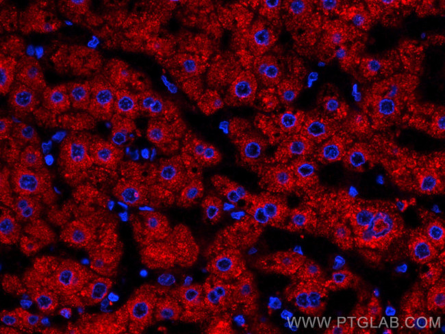 Plasminogen Antibody in Immunohistochemistry (Paraffin) (IHC (P))