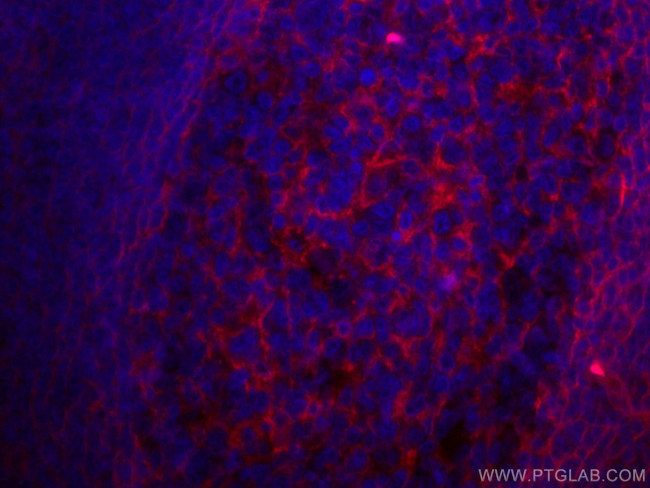 B7-H3 Antibody in Immunohistochemistry (Paraffin) (IHC (P))