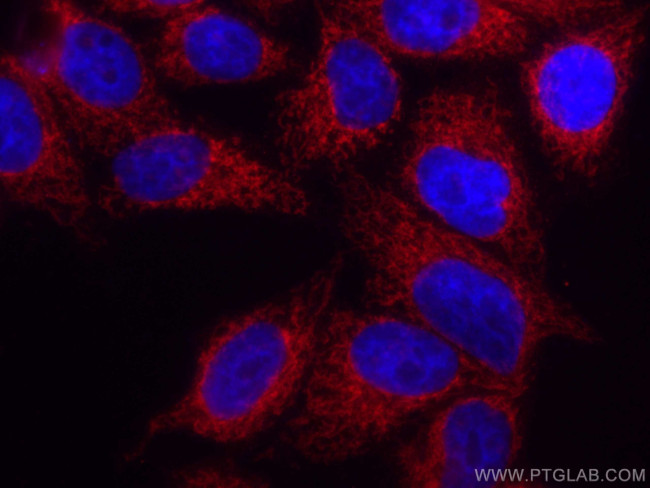 FIS1 Antibody in Immunocytochemistry (ICC/IF)