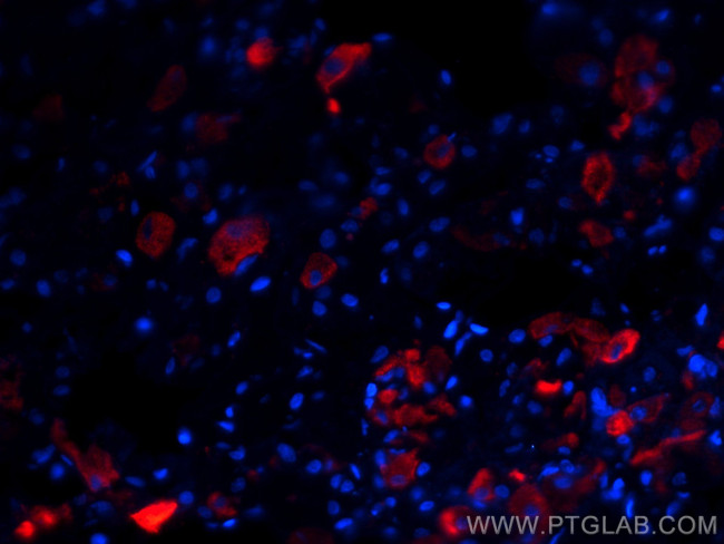 TSH Beta Antibody in Immunohistochemistry (Paraffin) (IHC (P))