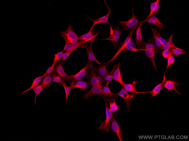 DKK3 Antibody in Immunocytochemistry (ICC/IF)