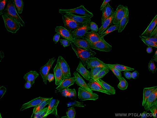 SREBF1 Antibody in Immunocytochemistry (ICC/IF)