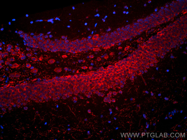 PTGER4 Antibody in Immunohistochemistry (Paraffin) (IHC (P))