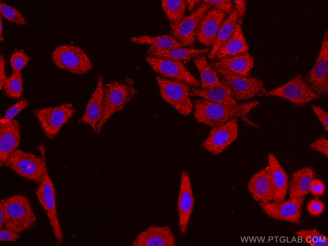 FGFR3 Antibody in Immunocytochemistry (ICC/IF)