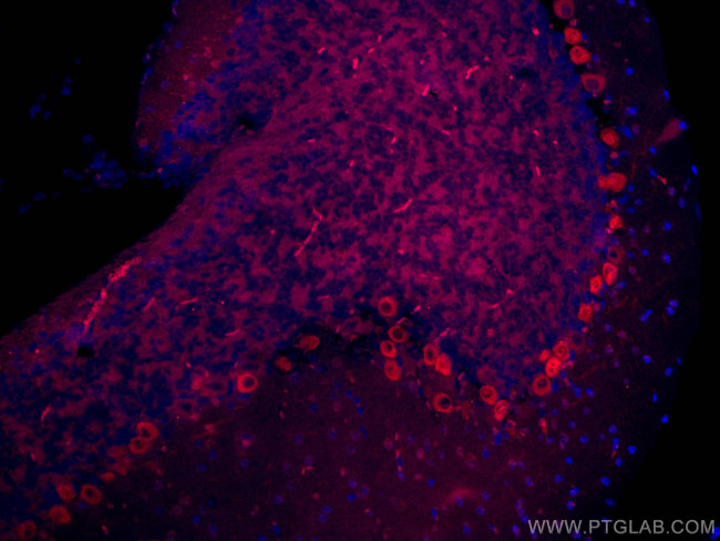 MYH10 Antibody in Immunohistochemistry (Paraffin) (IHC (P))