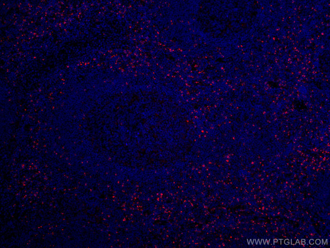 Granzyme K Antibody in Immunohistochemistry (Paraffin) (IHC (P))