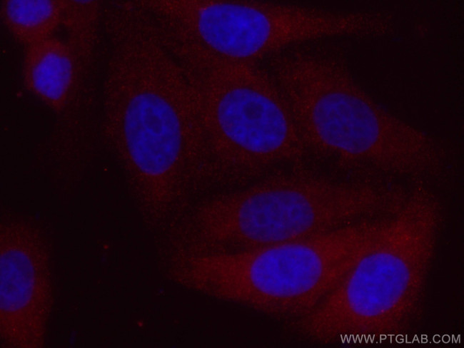 ACC1 Antibody in Immunocytochemistry (ICC/IF)