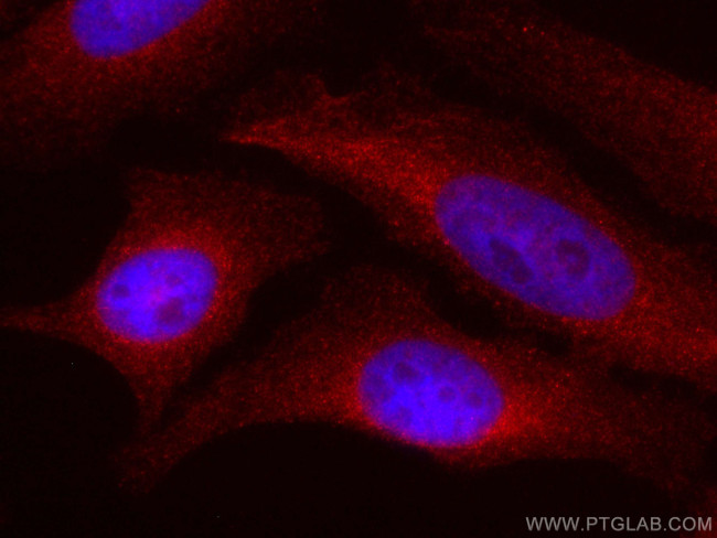 MEK2 Antibody in Immunocytochemistry (ICC/IF)