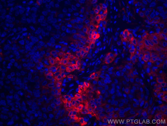 ERO1L Antibody in Immunohistochemistry (Paraffin) (IHC (P))