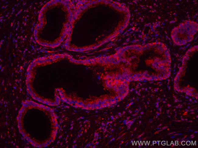 TAOK3 Antibody in Immunohistochemistry (Paraffin) (IHC (P))