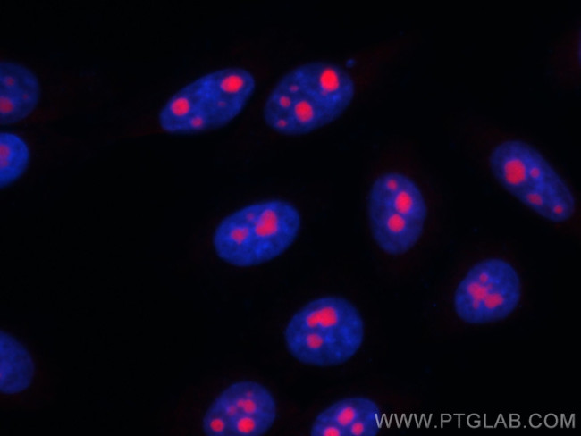 MYBBP1A Antibody in Immunocytochemistry (ICC/IF)