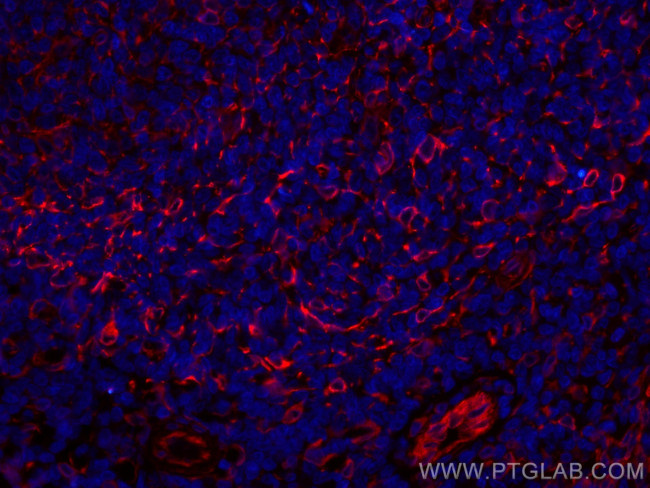 TMEM173/STING Antibody in Immunohistochemistry (Paraffin) (IHC (P))