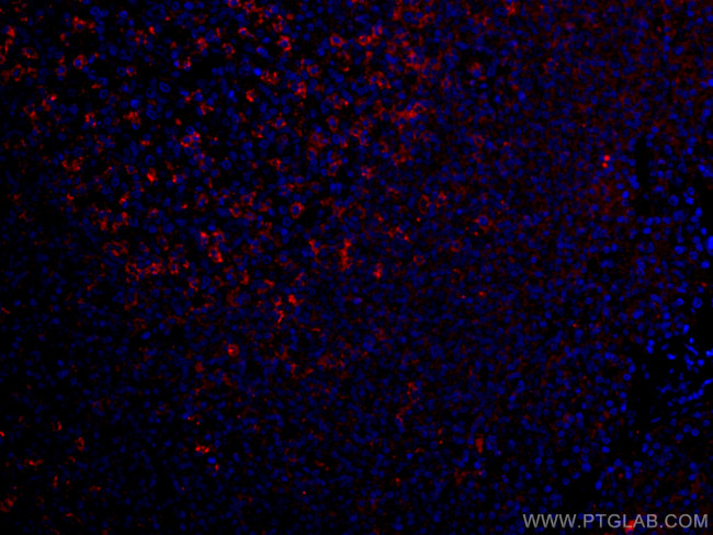 PD-1/CD279 Antibody in Immunohistochemistry (PFA fixed) (IHC (PFA))