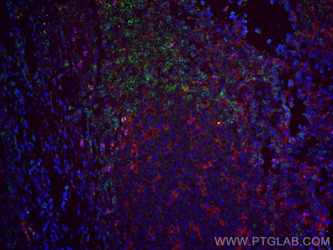 PD-1/CD279 Antibody in Immunohistochemistry (PFA fixed) (IHC (PFA))