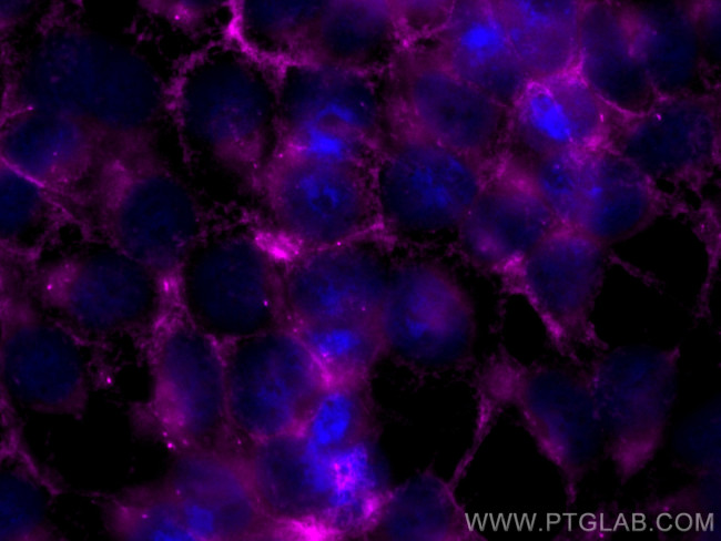 MTMR14 Antibody in Immunocytochemistry (ICC/IF)